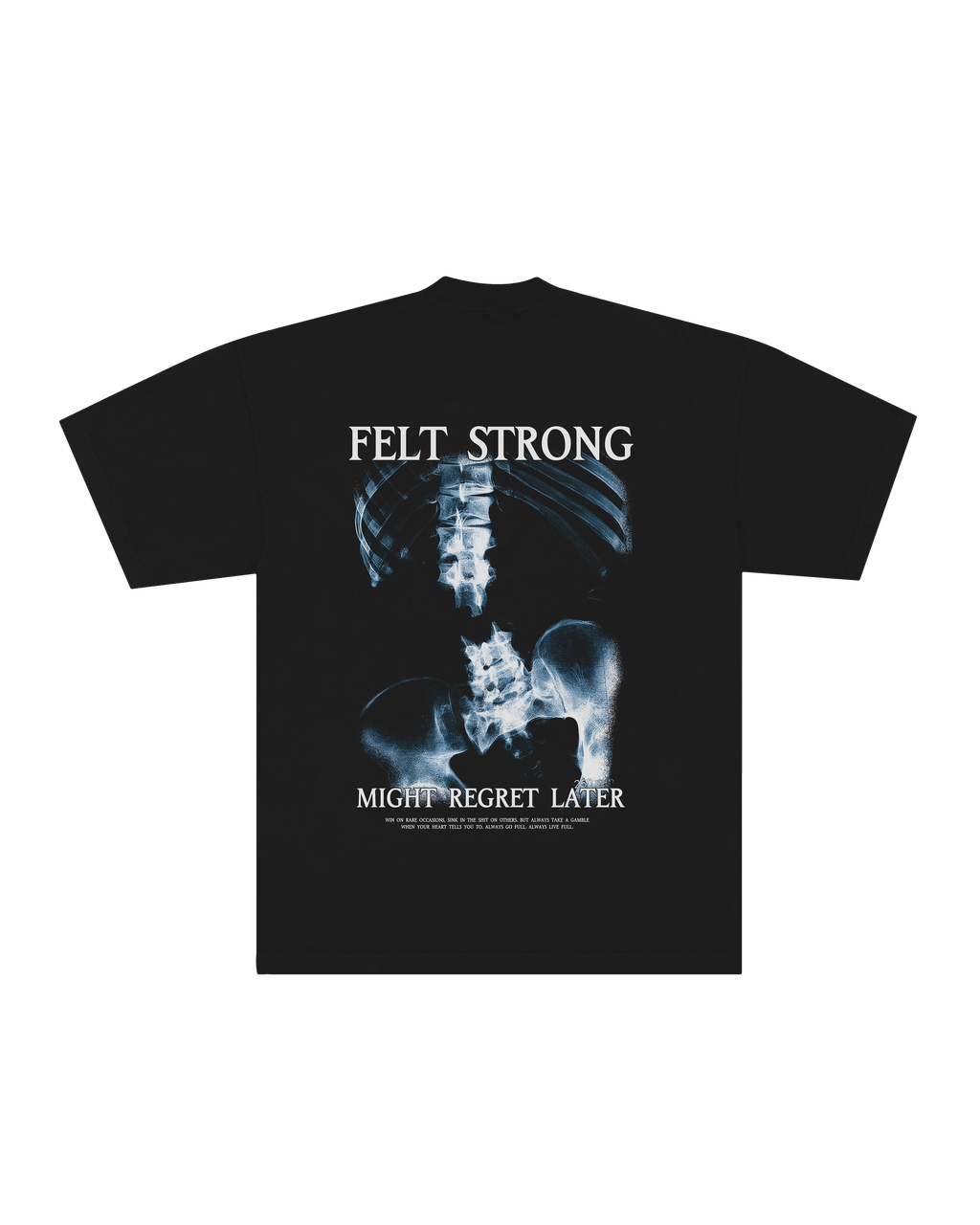 X-Ray Oversized Tee